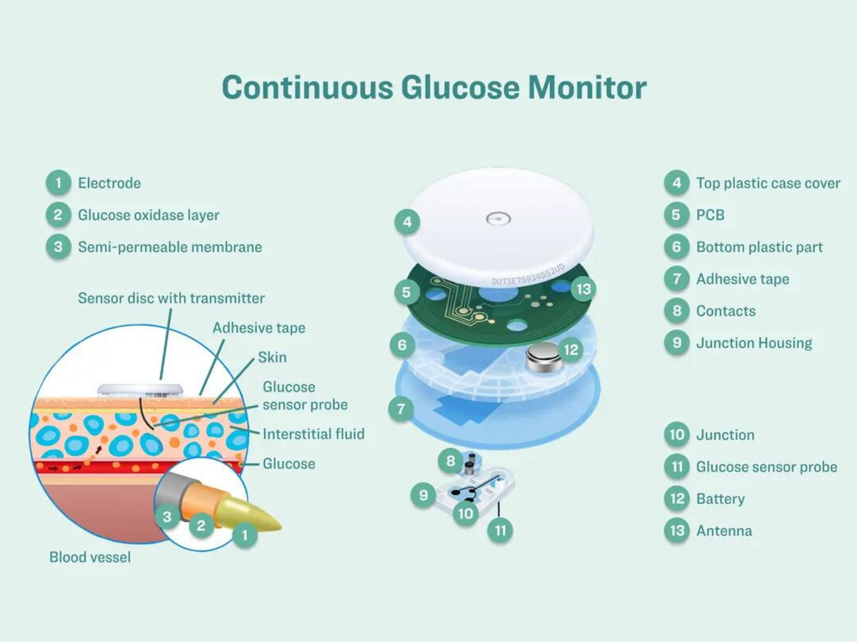 Συνεχής μετρητής γλυκόζης Beebird Accurect CGM-01